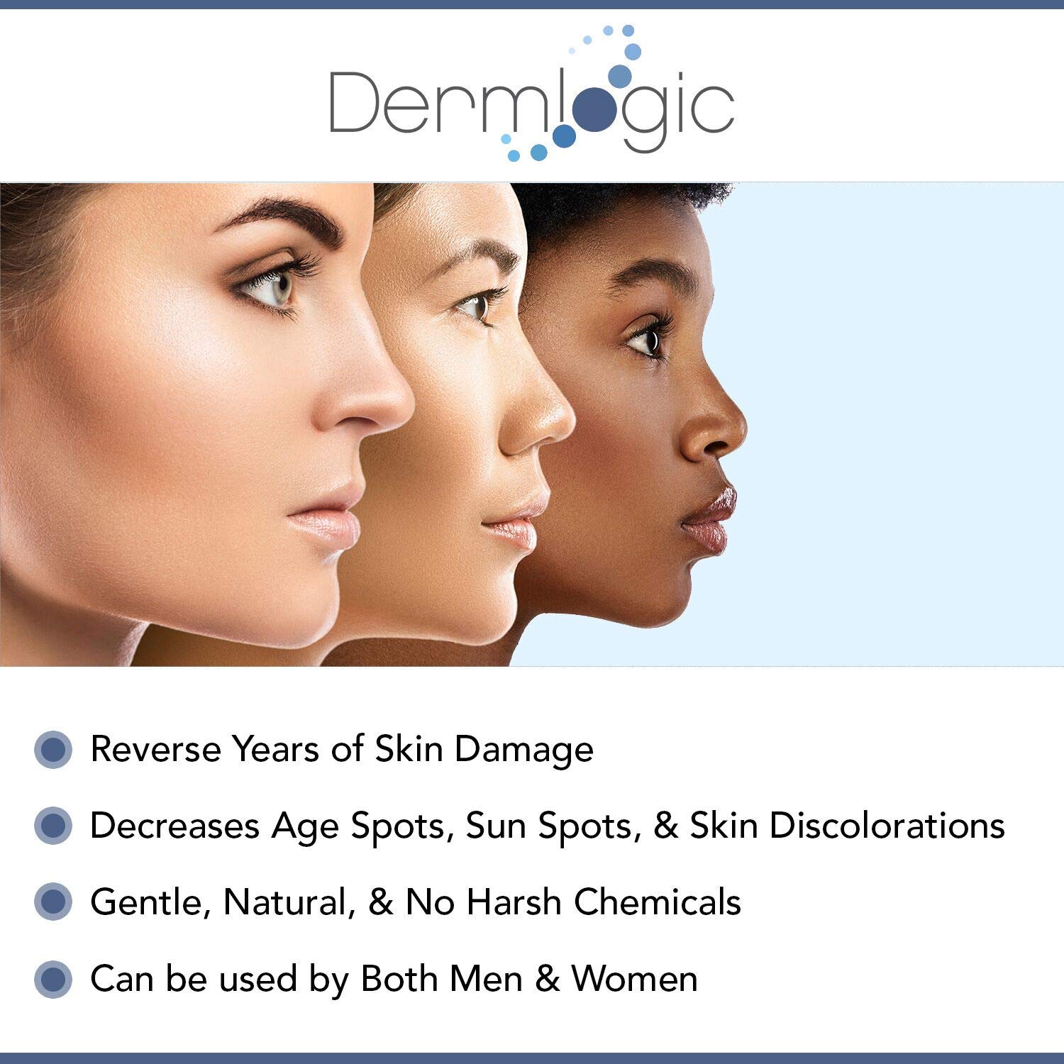 best sun spot removal cream