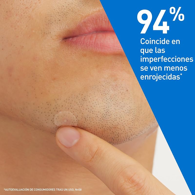 , Parches Anti-Granos, Con 3 ceramidas esenciales y niacinamida,