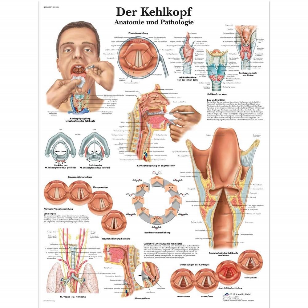 3B scientific anatomical chart 'Der Kehlkopf' ('The Larynx') [German language], VR0248UU