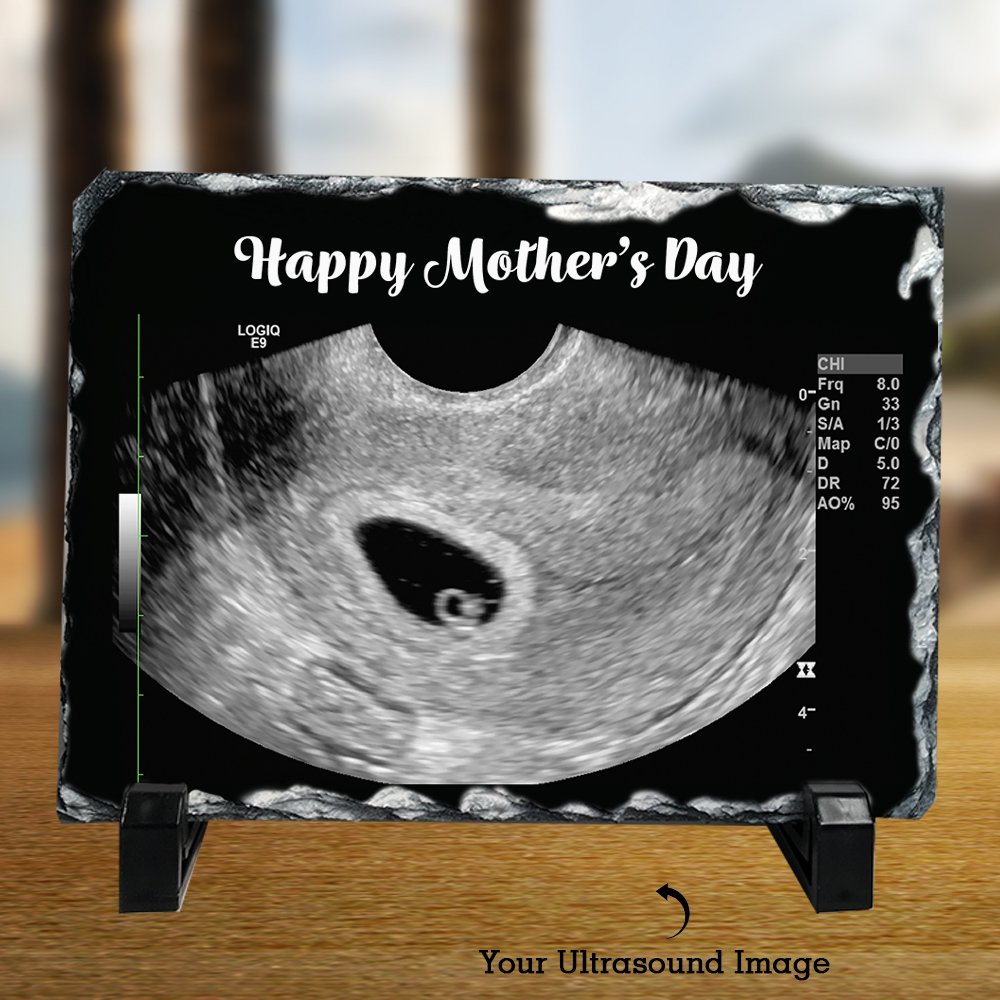 personalized ultrasound gifts
