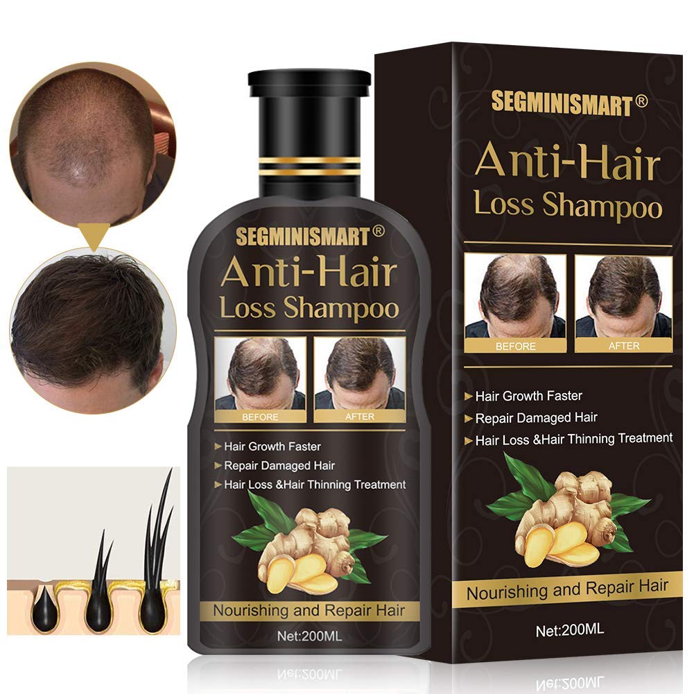 Hair Growth Shampoo,Anti-Hair Loss Shampoo,Hair Loss Shampoo,Hair Thickening Shampoo Helps Stop Hair Loss, Hair Growth for Stronger, Thicker, Longer Hair: Beauty