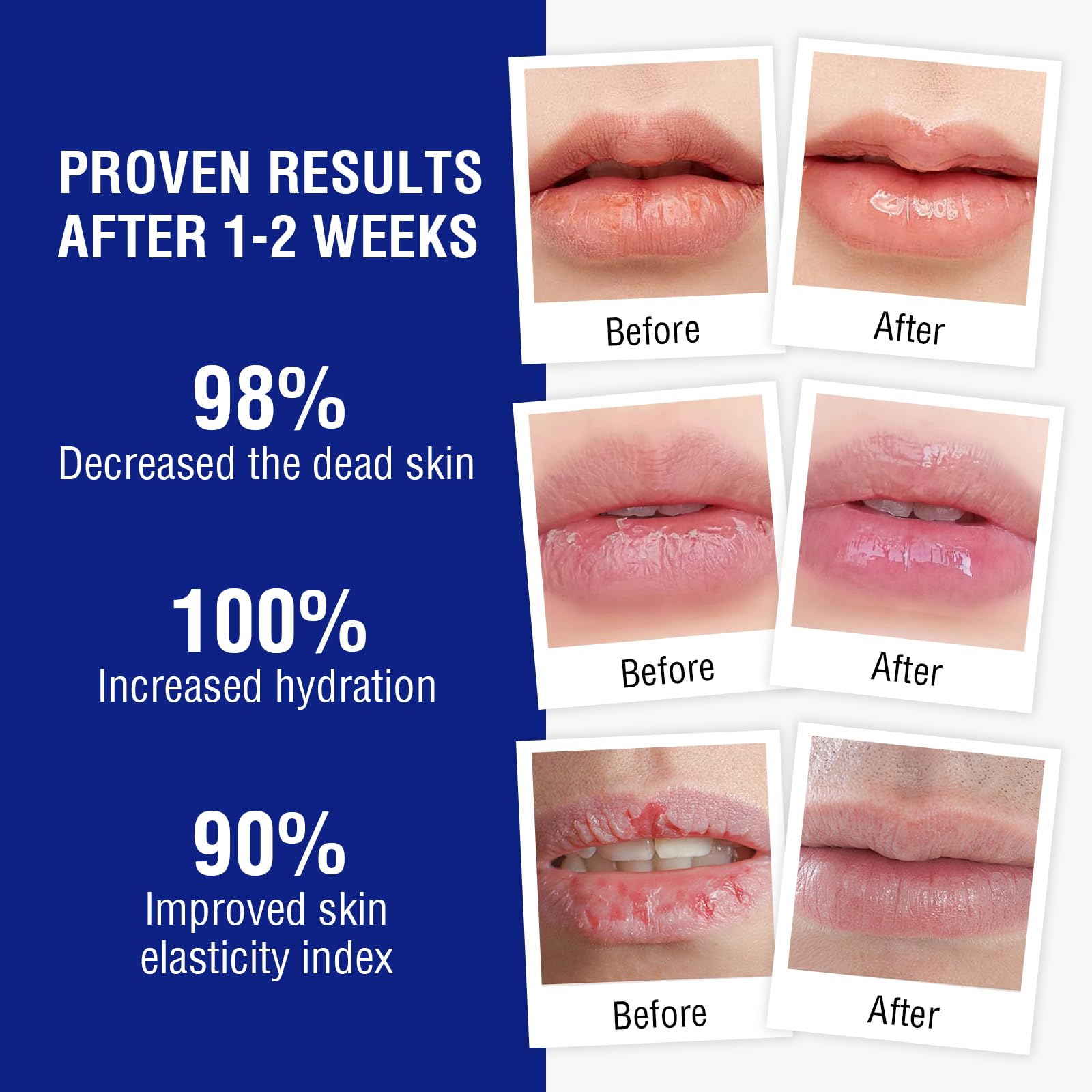 OUKEYA Lip Balm,0.25 Ounce,Medicated Lip Chapstick Medicated w/Beeswax,Petrolatum,Peppermint Oi,100% Natural Ingredients,Lip Moisturizer for Very Dry Lips,Echapped Lips Treatment Severe