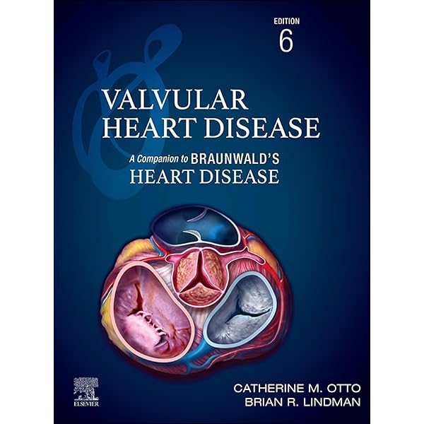 Amazon.com: Braunwald's Heart Disease - E-Book: A Textbook of