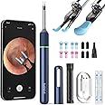 BEBIRD NOTE5 Ear Wax Removal Tool Camera Endoscope, 3Light Modes H-Speed WiFi 6Axis Intelligent Gyroscope Safe Professional 1080p Smart Visual Ear Cleaner with Camera for Kid Adult Pet(Blue)
