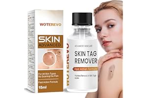 WOTEREVO Skin Tag Remover, Wart Remover, Fast Acting Gel Wart Remover Freeze Off -Fast-Acting Wart Freeze Off - Wart Removal for Plantar, Genital H Flat 1 Pack Yellow