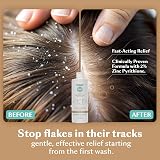 DHS Zinc Shampoo 16oz Dandruff Itching Relief Seborrheic Dermatitis Control view 3