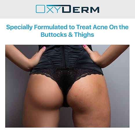 good soap for oily face