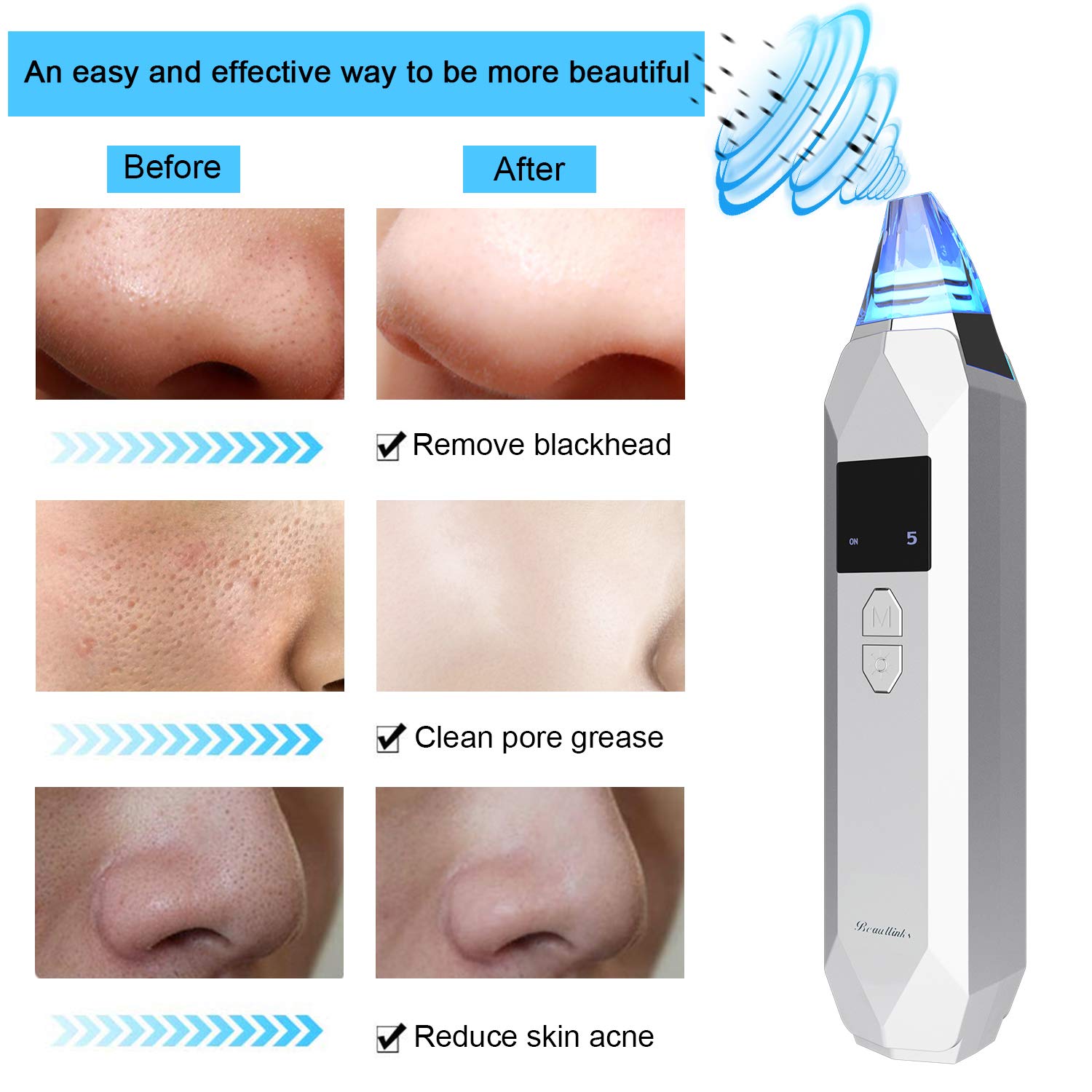 Aspirateur Point Noirs Extracteur Rechargeable, Beautlinks Facial Pores Nettoyant Point Noir, Retirer les Blackhead Visage avec 3 LED Lumières de Beauté, 5 Niveaux et 5 Têtes d\'Aspiration