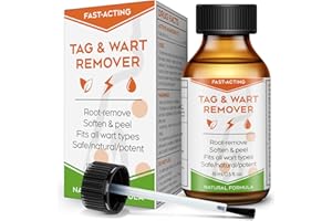 "STAY STOKED" Wart Remover, 15 ml Skin Tag Remover Freeze Off - Plantar Wart Remover for Feet with Salicylic Acid - Best Wart Removal for Common Wart, Flat Wart, Corn - Strongest Dermatologist- Tested Formula-C5517