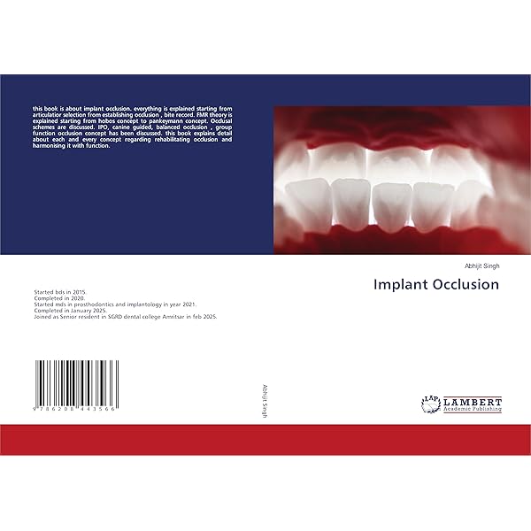 ITI Treatment Guide: Loading Protocols in Implant Dentistry