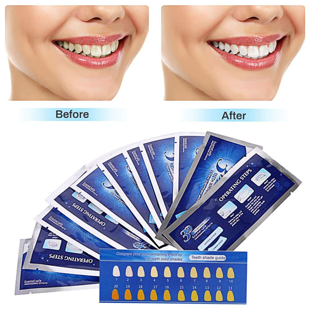 Diy Teeth Whitening Strips With Foil And Toothpaste Medical Supplies