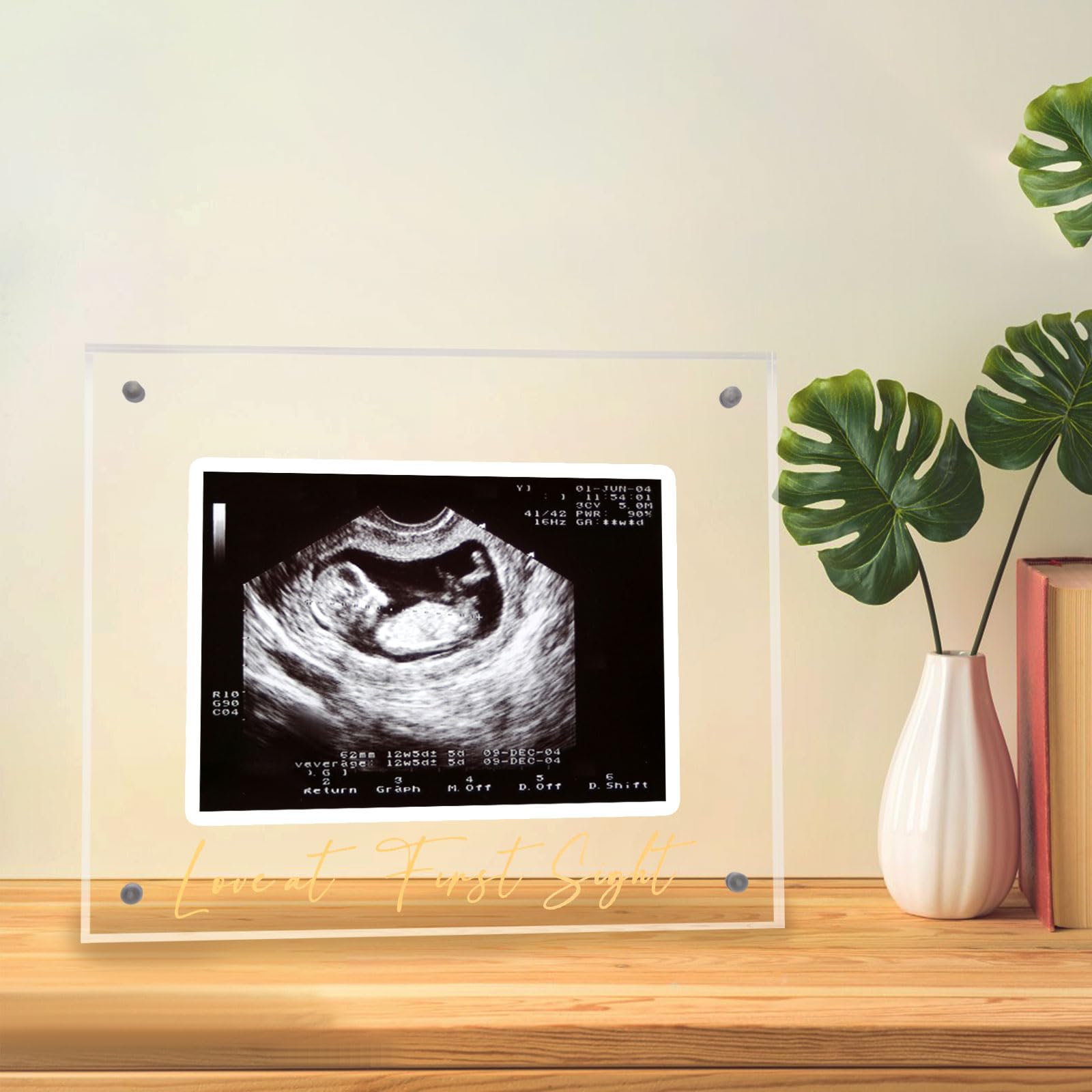 Acrylic Ultrasound Picture Frame, Bright Photo Frame, Sonogram Love at First Sight Baby Keepsake Baby Announcement, Birth Information, Expecting Mom Parents to be Unique Gifts for Pregnant