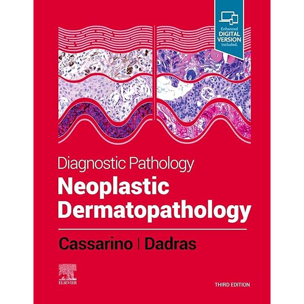 眼科病理:希少洋書専門書Ophthalmic Pathology 眼科病理:希少洋書専門書Ophthalmic Pathology