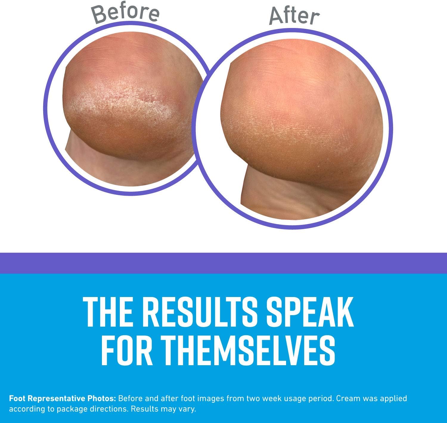 O'Keeffe's Healthy Feet Night Treatment Foot Cream, 3.0 Ounce Tube, (Pack of 1): Home Improvement