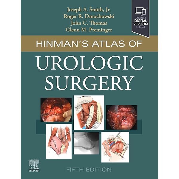 Amazon.com: Complications of Urologic Surgery: Prevention