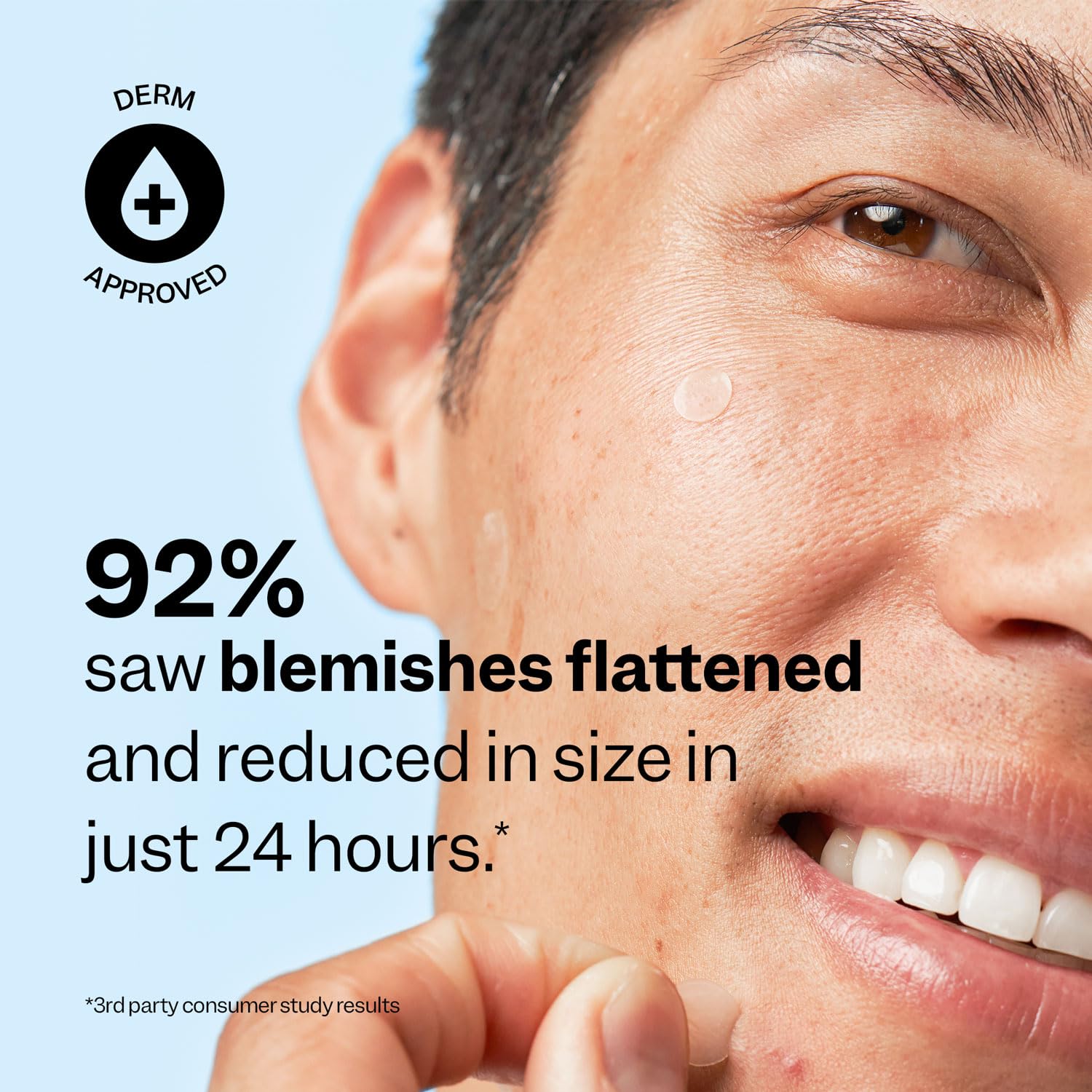 Peach Slices - Acne Spot Dots (30 ct) - Hydrocolloid Pimple Patches for Face - Absorb Gunk, Protect Picking & Support Healing - 3 Sizes (7, 10, & 12mm) - Vegan, Cruelty Free, Korean Skin Care & Beauty