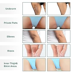 Vcetree Skin Bleaching Cream Skin Lightening for