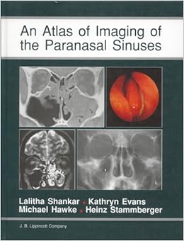 An Atlas Of Imaging Of The Paranasal Sinuses