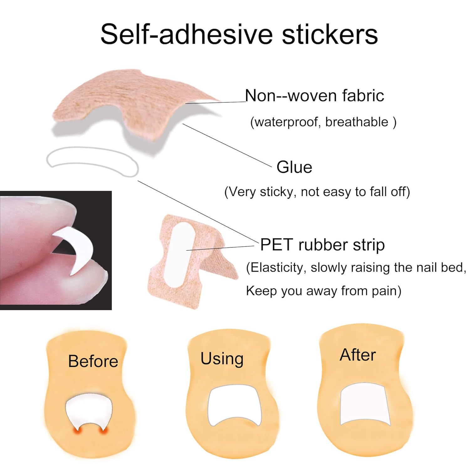 Ingrown Toenail Tools With Corrector Stickers, 30 Pcs Toe Nail Lifter Treatment Patch for Pedicure, Fix Curved Toenail Tape Recover Correction for Paronychia (Gold): Beauty