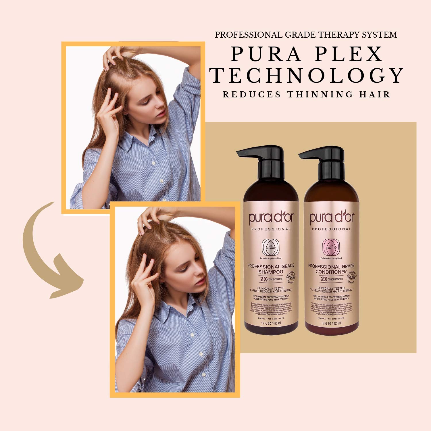 PURA D'OR Professional Grade Anti-Hair Thinning 2X Concentrated Actives Biotin Shampoo & Conditioner (16oz x 2), No Sulfates, Clinically Tested, All Hair Types, Men & Women (Packaging Varies) : Beauty