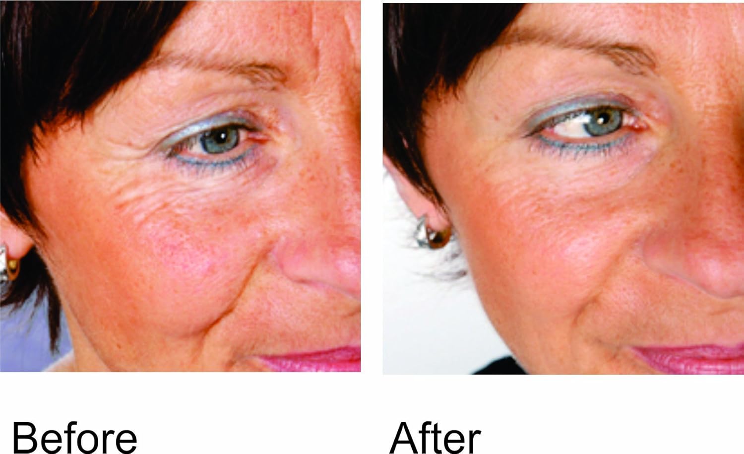 eterno skin care before and after