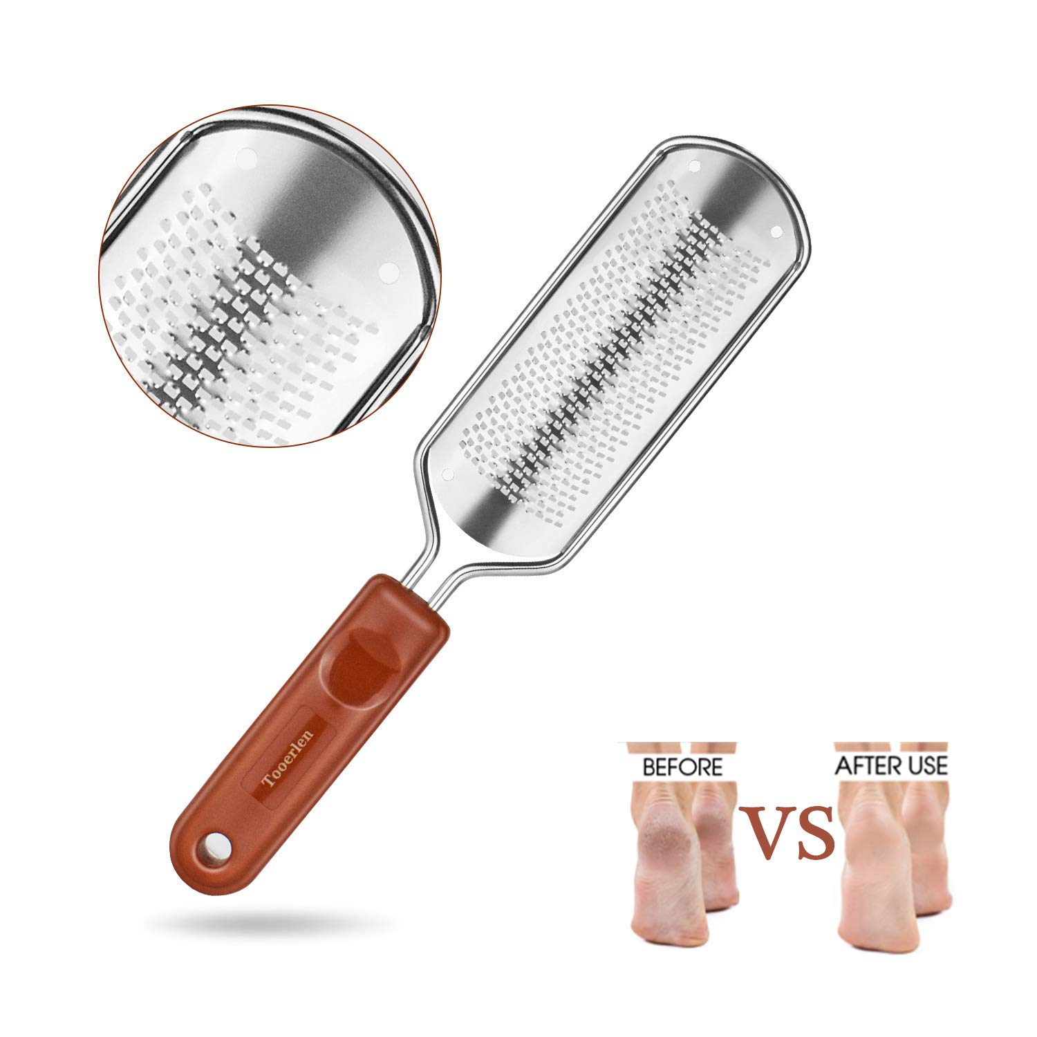 Tooerlen Foot Rasp Foot File Foot Grater, Can be Used on Both Wet and Dry Feet, Best Foot Care Pedicure Metal Surface Tool to Remove Hard Skin, for Extra Smooth and Beauty Foot- (Colossal) : Beauty
