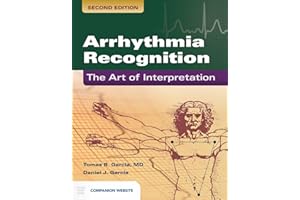 Arrhythmia Recognition: The Art of Interpretation: .