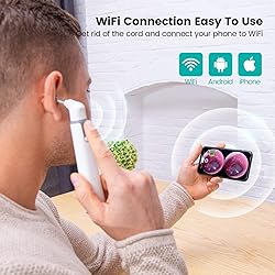 Anykit Wireless Otoscope Ear Camera with Dual