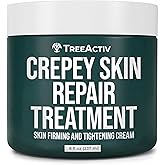 TreeActiv Crepey Skin Repair Cream, 8 oz Firming Body & Neck Cream with Hyaluronic Acid, Glycolic Acid & Shea Butter, Helps Crepey Skin Look Smoother, 500+ Uses