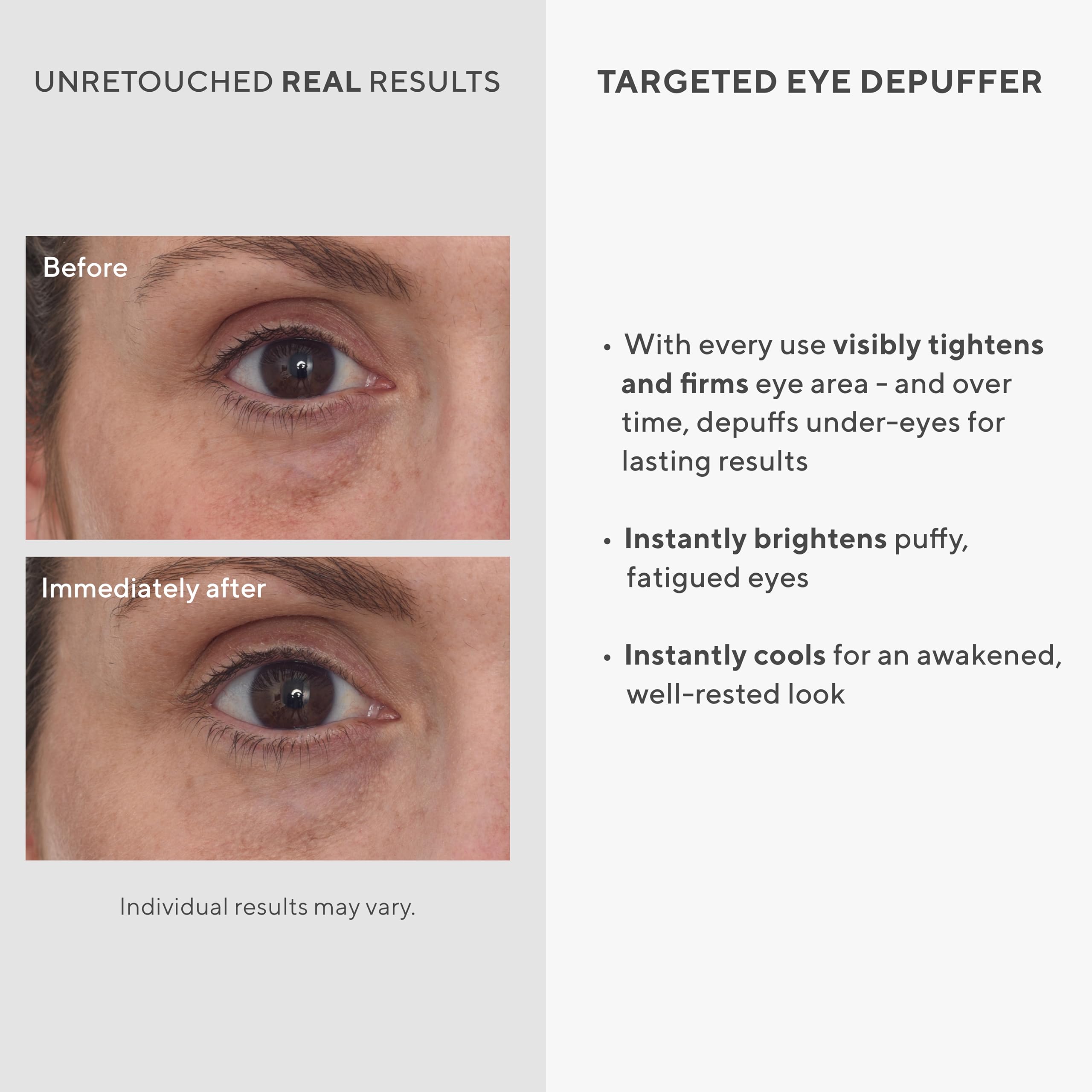 Murad Targeted Eye Depuffer – Ginseng, Lily, and Caffeine Eye Cream Fights Fatigued and Stressed Appearance by Brightening, Depuffing, and Firming Under-Eye Bags – 0.5 Fl Oz