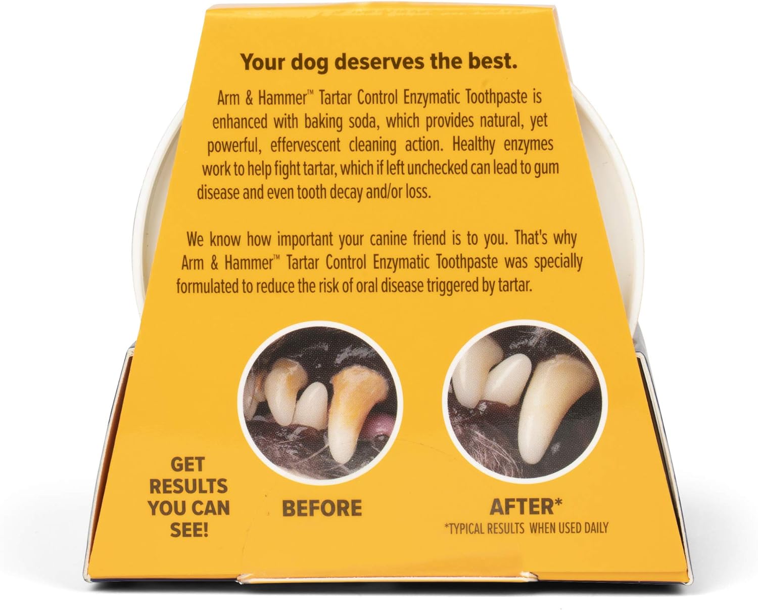 Arm & Hammer Dip & Brush Tartar Control Enzymatic Toothpaste Kit for