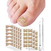 Ingrown Toenail Treatment, Includes 2 Types of 60Pcs Ingrown Toenail Corrector Patch, Professional Ingrown Toenail Tool with 