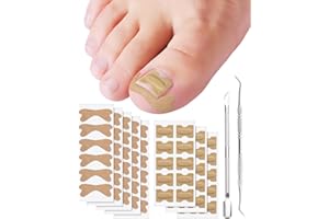 Ingrown Toenail Treatment, Includes 2 Types of 60Pcs Ingrown Toenail Corrector Patch, Professional Ingrown Toenail Tool with 