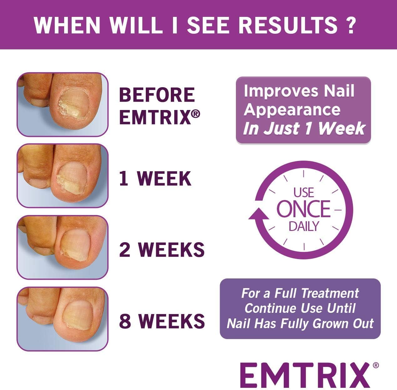 Emtrix® Fungal Nail Treatment Cream, Extra Strength Nail Fungus Penetrating Formula, Binds Moisture into the Nail - Image 5