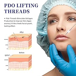 SOZOOM PDO Mono Thread, Pdo Threads Stimulate