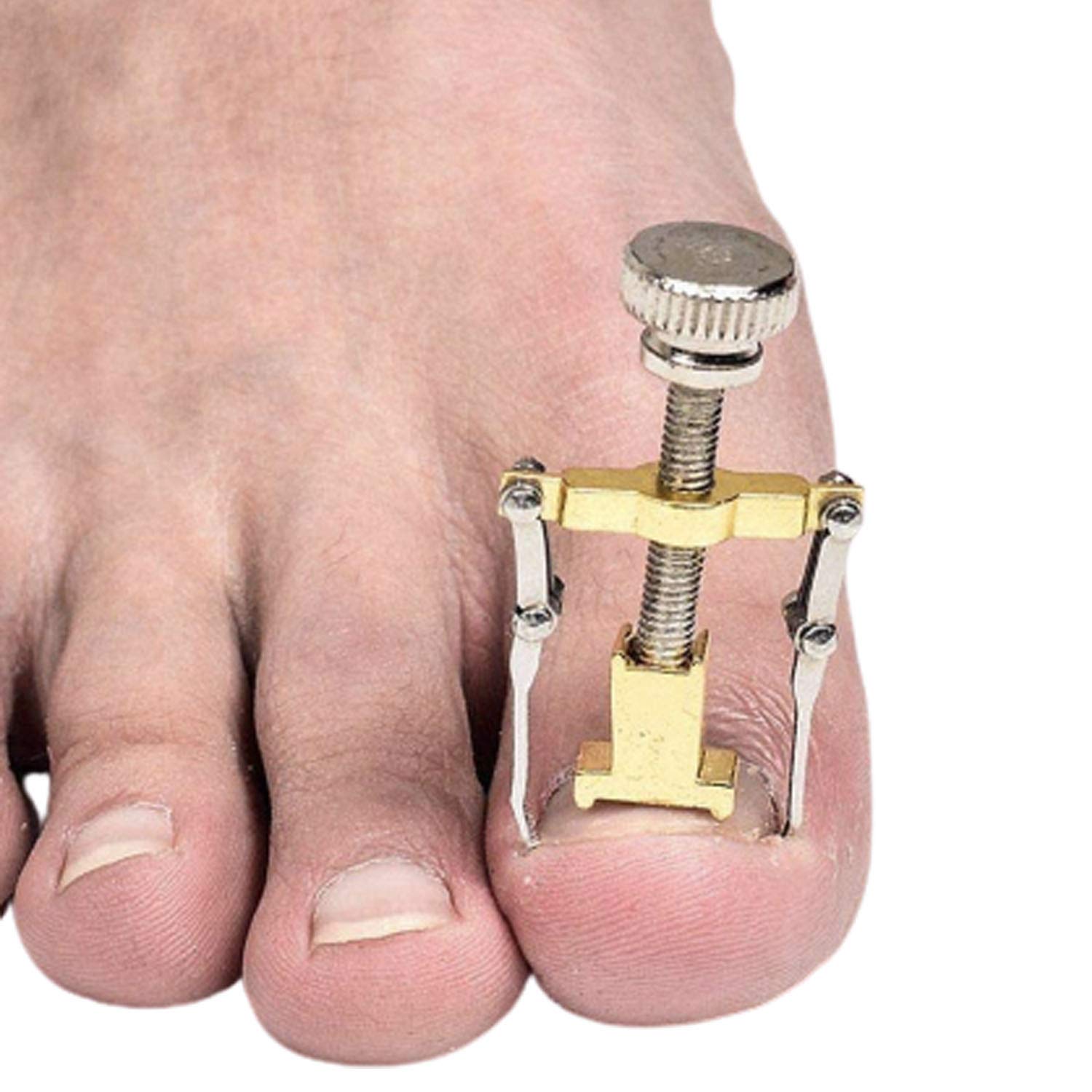 Ingrown Toenail Tool GLAMZA Corrector Clamp for Safe & Effective Treatment of Ingrown Toenail