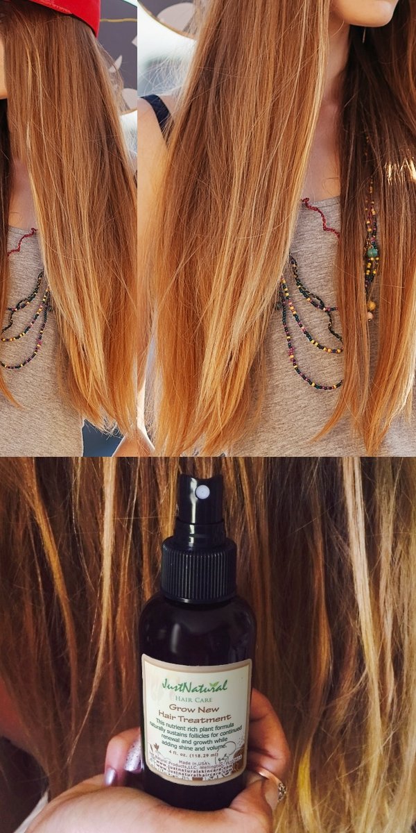Buy Grow New Hair Treatment Online At Low Prices In India Amazon In