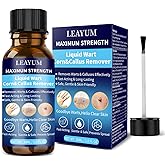 LEAYUM Wart Remover Fast-Acting 17% Salicylic Acid Freeze Off Treatment for Flat, Plantar, Calluses Maximum Strength Wart Removal Kit for Men & Women (30ML)