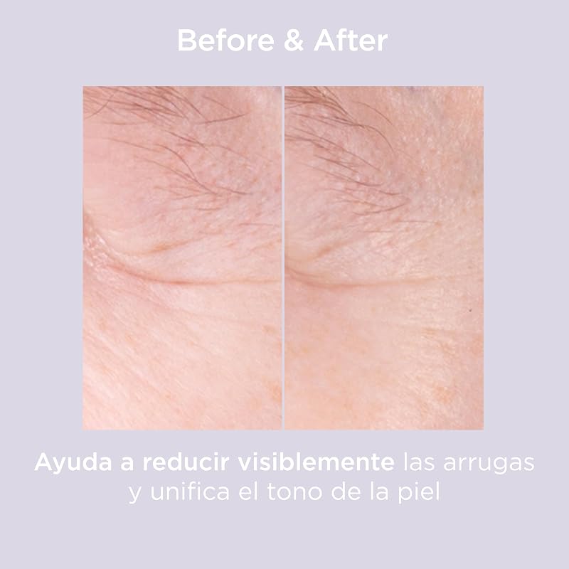 Isdinceutics Glicoisdin 25 Gel Exfoliante con Ácido Glicólico, Acción Exfoliante para Una Piel Renovada, 25 g