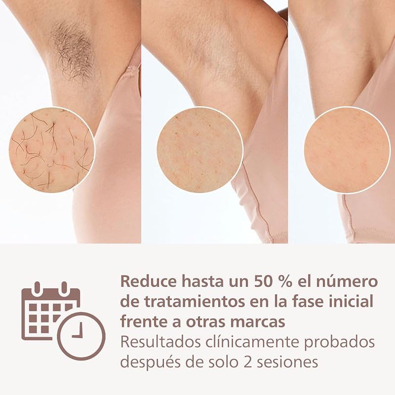 Philips lumea prestige ipl bri949 – depilação à base de luz para uma pele suave e duradoura – inclui 4 cabeças especiais e corretivo