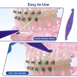 JMU Orthodontic Elastics 3/16 Inch Heavy 6.5oz 100