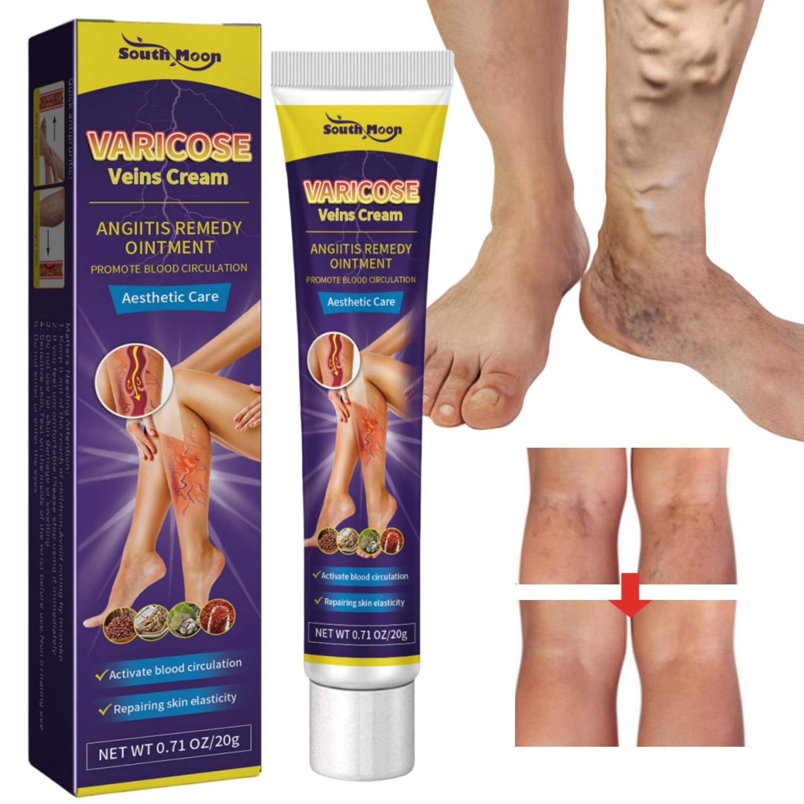 Mua Varicose Veins Cream,Spider Vein Cream,Varicose Veins Treatment for