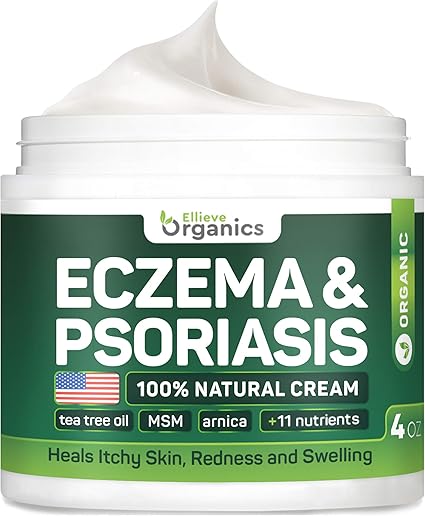 Amazon Com Psoriasis Eczema Cream Natural Eczema Treatment With Tea Tree Oil Msm Honey Arnica Made In Usa Powerful Dermatitis Irritation Psoriasis Treatment Steroid Free Psoriasis Cream Amazon Com Psoriasis Eczema Cream Natural Eczema Treatment With Tea Tree Oil Msm Honey Arnica Made In Usa Powerful Dermatitis Irritation Psoriasis Treatment Steroid Free Psoriasis Cream