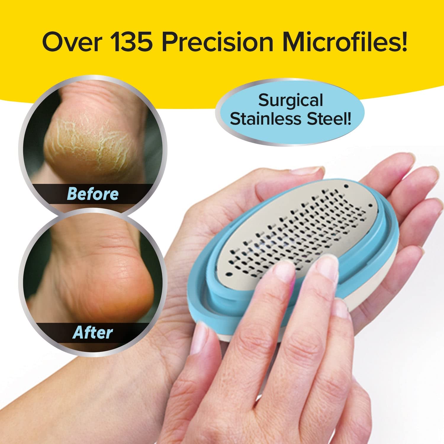 PedEgg Classic Callus Remover, As Seen On TV, New Look, Safely & Painlessly Remove Tough Calluses Dry Skin to Reveal Smooth Soft Feet, 135 Precision Micro-Blades, Traps Shavings, White, 3357, 4''