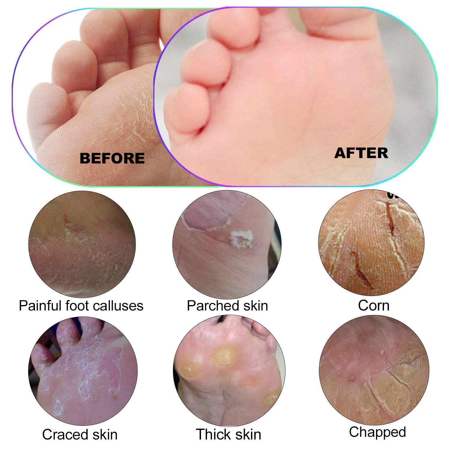 Foot Scrubber Pedicure Foot File - Callus Remover for feet Ejiubas Professional Foot File Rasp Colossal Feet Scrubber for Wet and Dry Feet Golden : Beauty