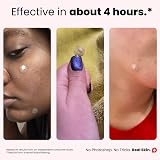 ROSELYNBOUTIQUE Pimple Patches 150 Dots 4 Sizes Hydrocolloid Face Set view 5