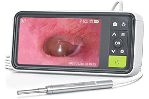 AnyScope 1080P Digital Otoscope with Gyroscope, 3.9mm Ear Scope Camera with 6 Lights, 4.5 Inches Screen, Ear Wax Removal Tool, 32GB Card, Supports Photo Snap and Video Recording