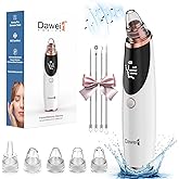 Blackhead Remover Pore Vacuum for Face & Nose – Deep Cleansing Blackhead Remover Tools with 3 Suction Levels, 5 Replaceable Tips, USB Rechargeable Pore Cleaner