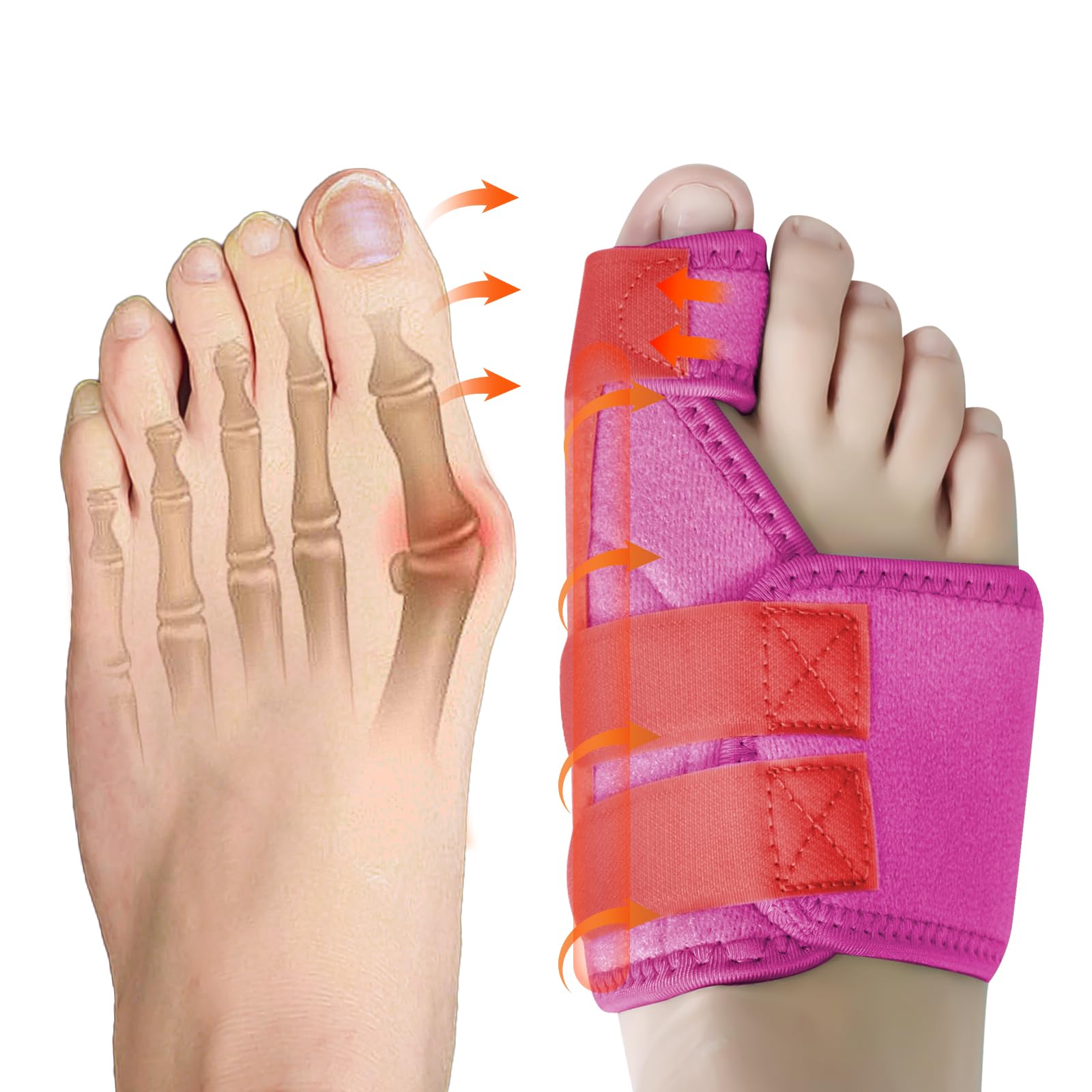 Ruilaibao Bunion Corrector Big Toe Straightener for Women and Men Bunion Splint for Big Toe Pain Relief Bunion Support for Day Night Foot Pain Relief (Rose red, right)