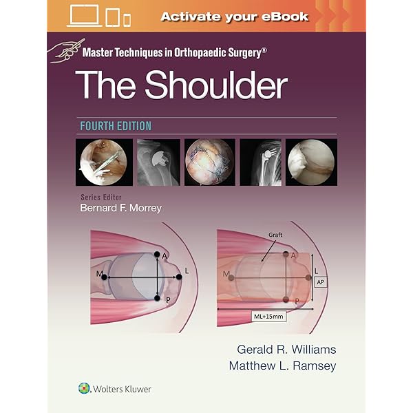 洋書 Surgical and Endovascular Treatment of A Surgical and endovascular treatment of unruptured cerebral